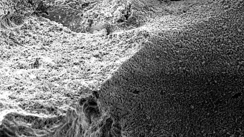 Guided Tissue Regeneration in Surgical Endodontic Treatment: Case Report and Literature Review