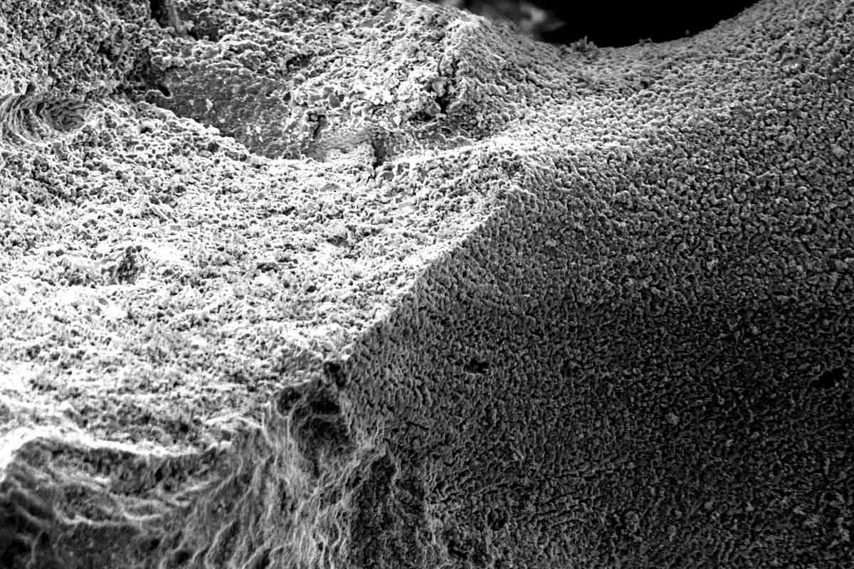 Guided Tissue Regeneration in Surgical Endodontic Treatment: Case Report and Literature Review