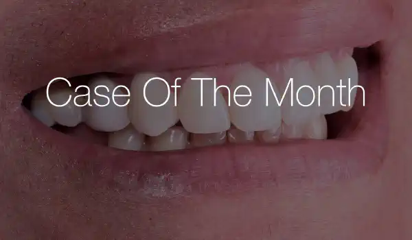 Image for case Management of a Late Ti Mesh Exposure in the Aesthetic Area using Jason® membrane & cerabone® in a Sausage Technique approach