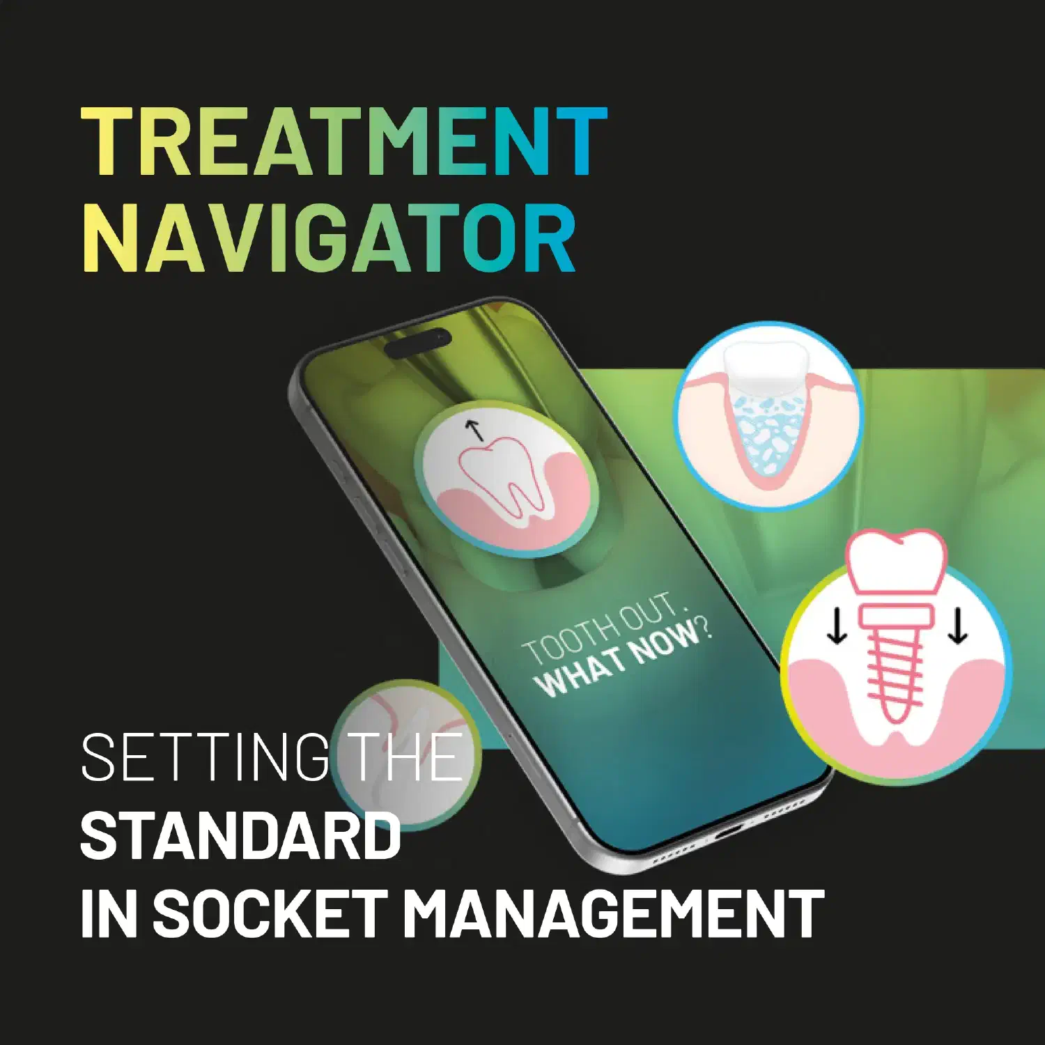 Treatment Navigator – setting the standard in socket management