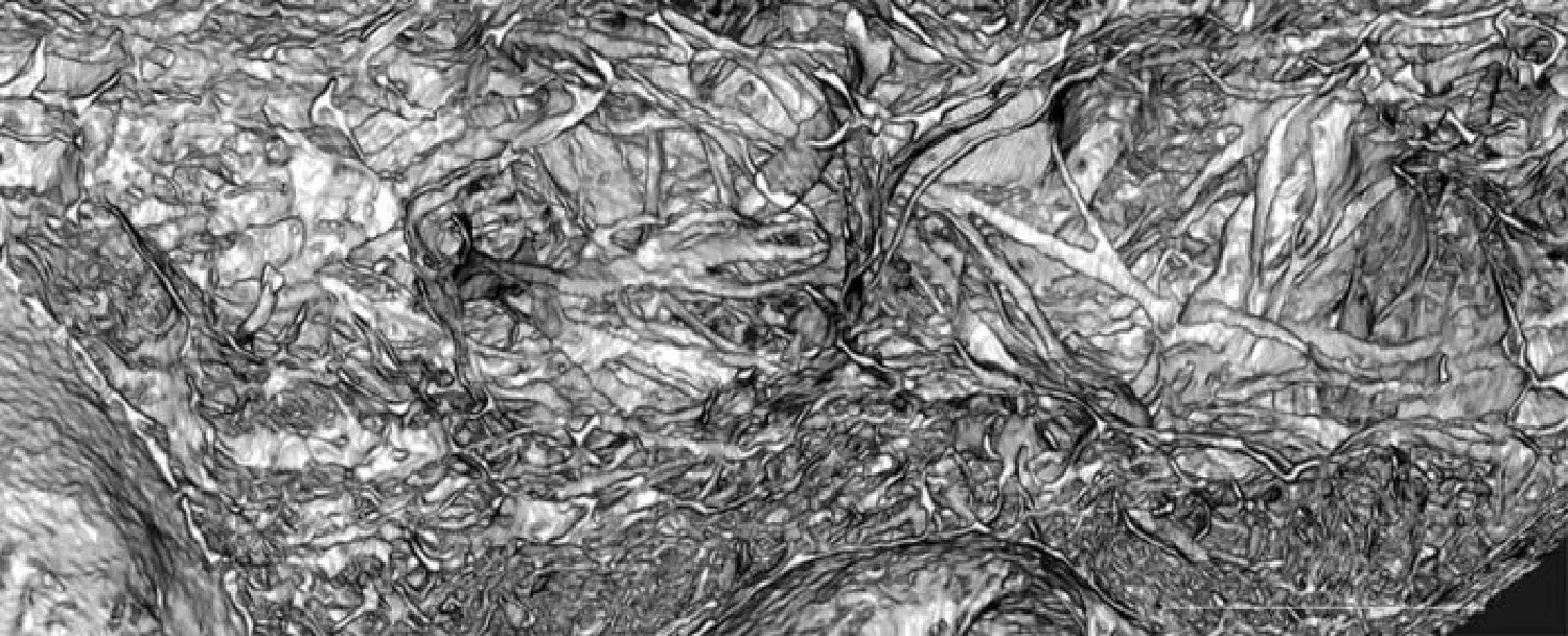 Synchrotron-based x-ray image showing the porous structure of mucoderm®
