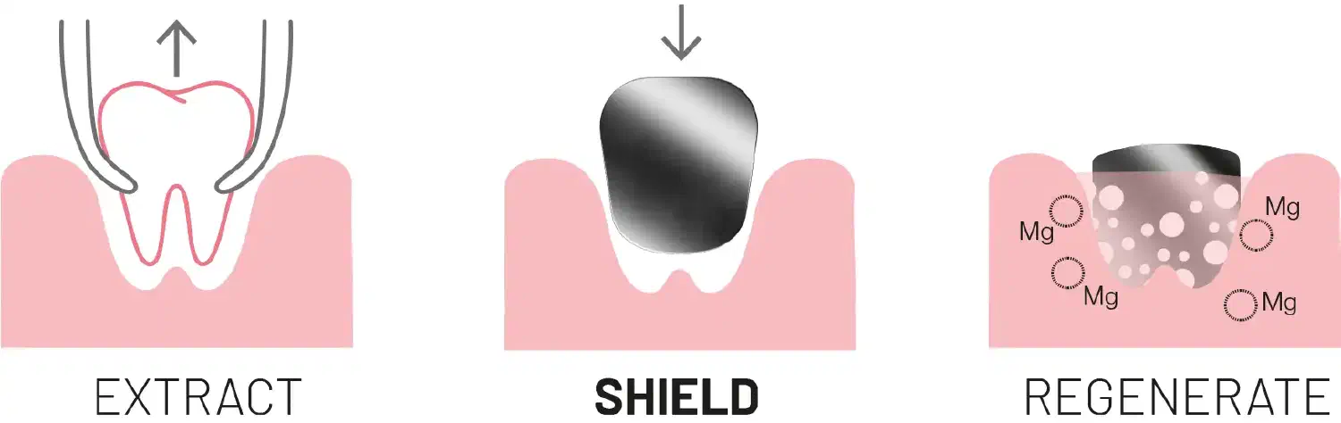 Extract, shield, regenerate