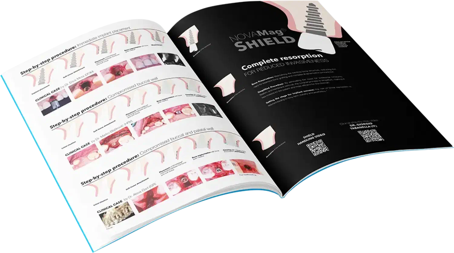 Casebook with step-by-step procedures using NOVAMag® SHIELD